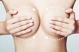 Wow Bust - zur Brustvergrößerung - forum - preis - Aktion